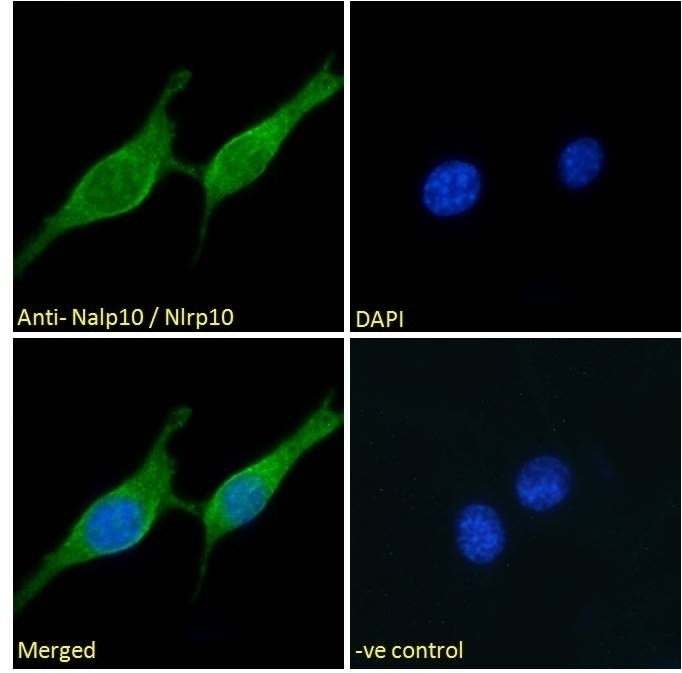 Trpc6 Antibody