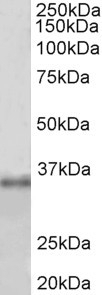ABCD2 Antibody