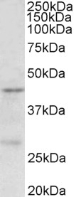 UBN1 Antibody
