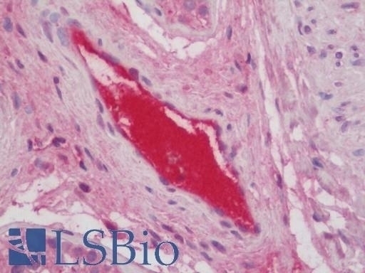 SH3GL2 Antibody
