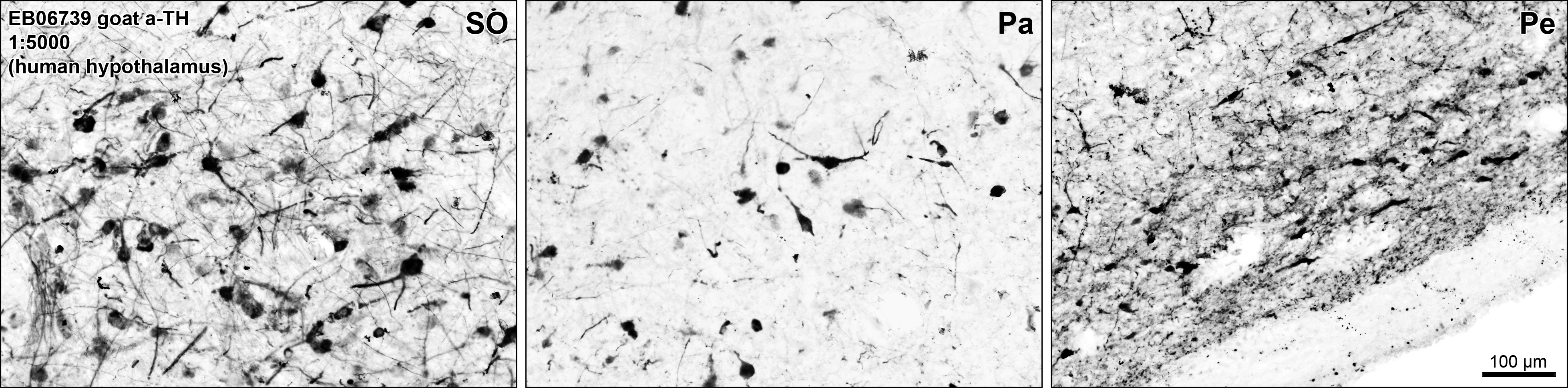 Tyrosine Hydroxylase Antibody