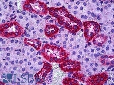 SH2D3A / NSP1 Antibody
