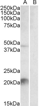 Afamin / alpha Albumin Antibody