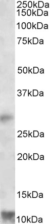 ACAT1 Antibody