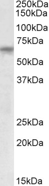 ANTXR2 / CMG2 Antibody