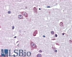 BDNF Antibody