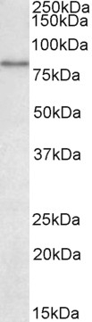 SLC26A6 Antibody