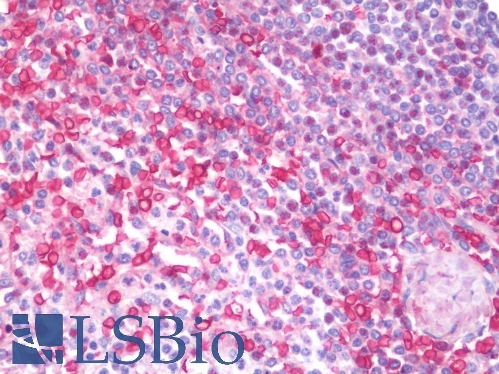 ADRA1B Antibody