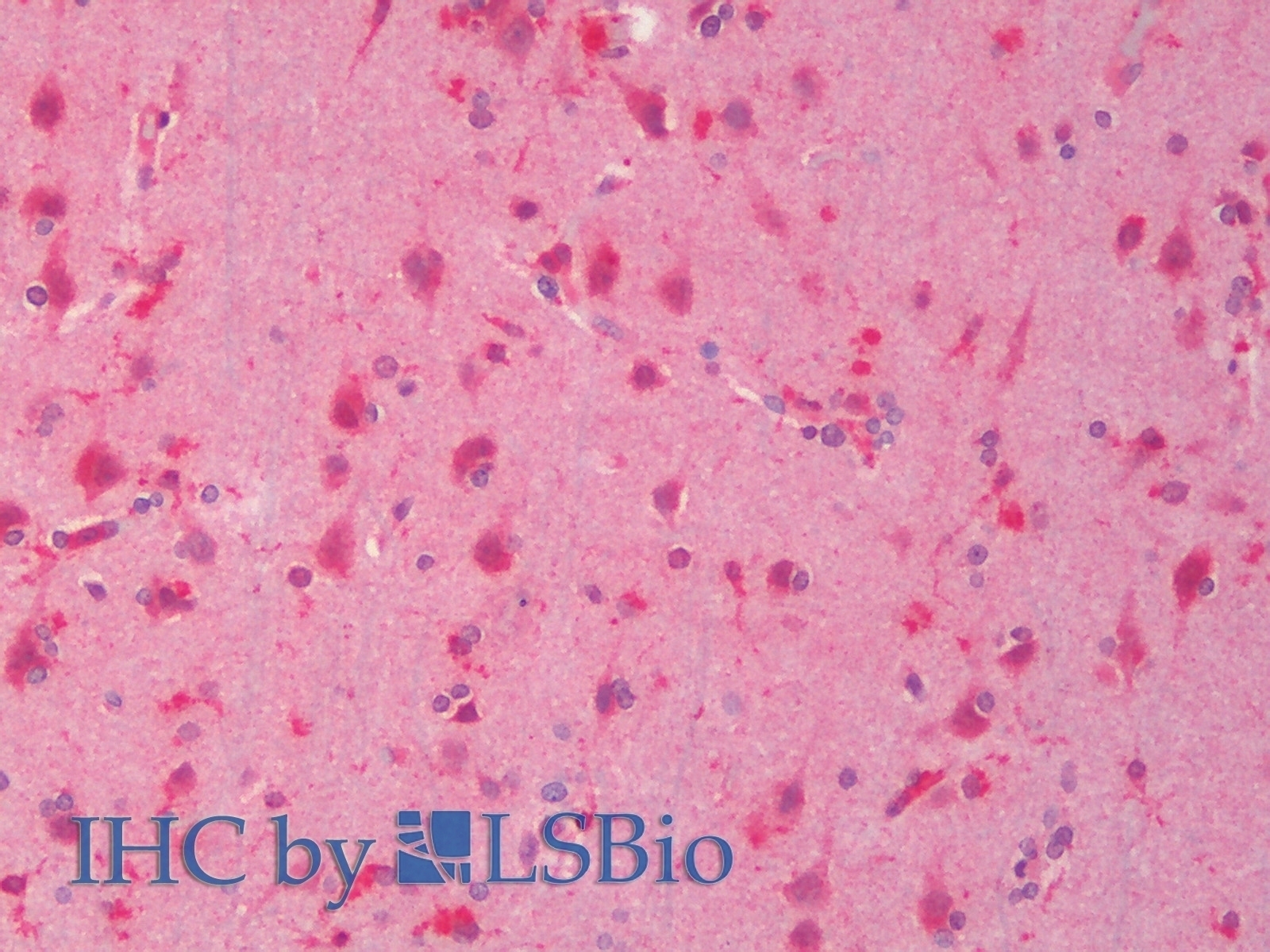 TNNI3 Antibody