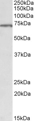 TNNT3 Antibody