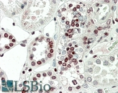 MK5 / MAPKAPK5 Antibody