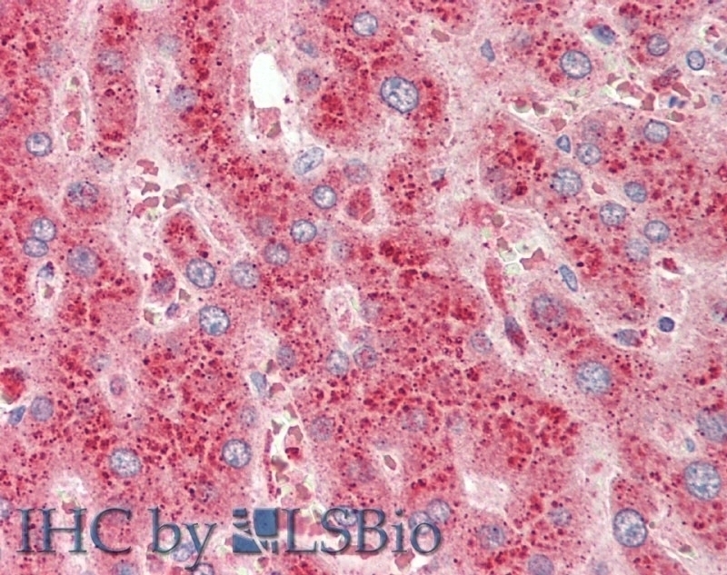 MK2 / MAPKAPK2 Antibody