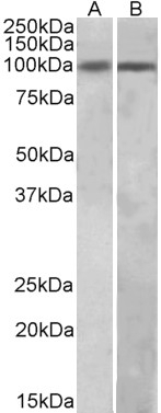 BEND5 Antibody