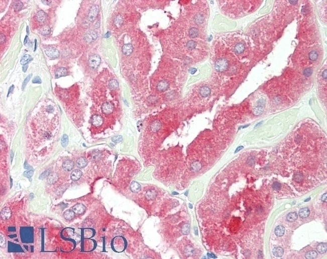 SLC26A1 / SAT-1 Antibody