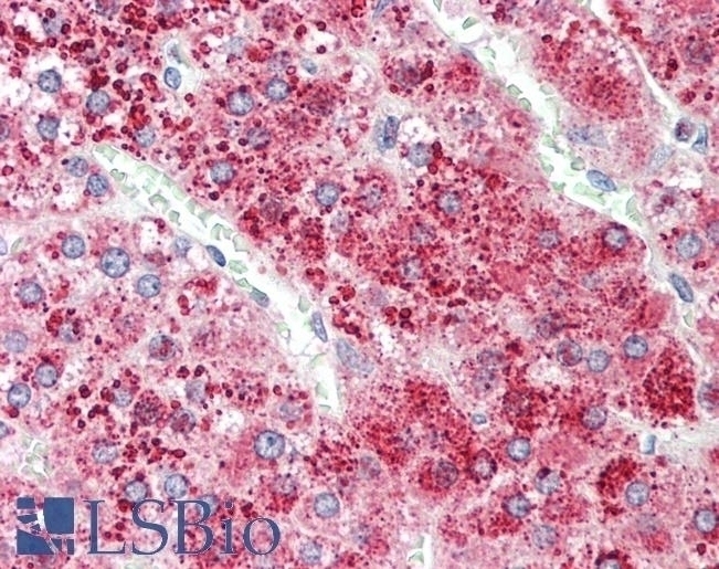 alpha-1-antitrypsin Antibody
