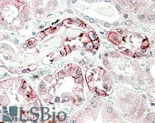 alpha-1-antitrypsin Antibody