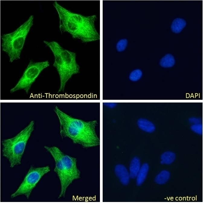apolipoprotein D Antibody