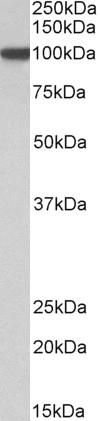 alpha-1-antichymotrypsin Antibody