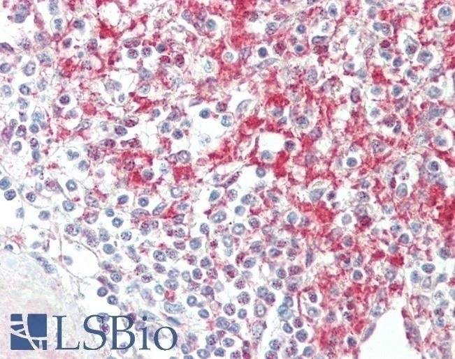 keratin 18 Antibody