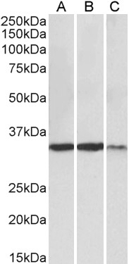 ADAM12 Antibody