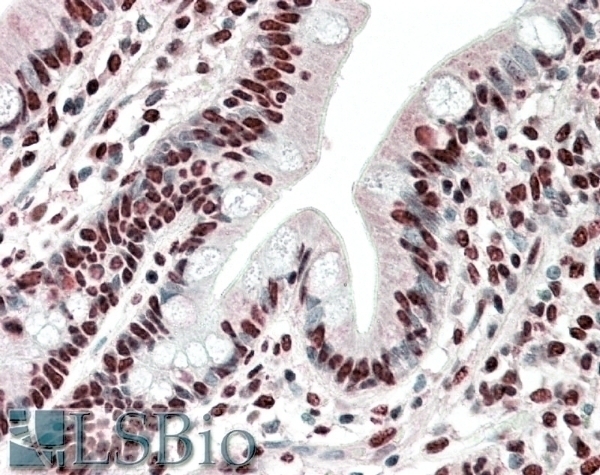 ARNT Antibody