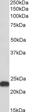 ALDOA Antibody