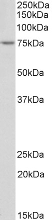 alpha-2-macroglobulin Antibody