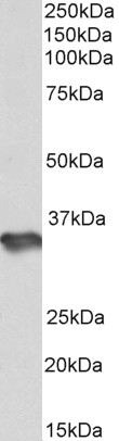 ATP5B Antibody