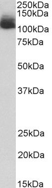 ATP5C1 Antibody