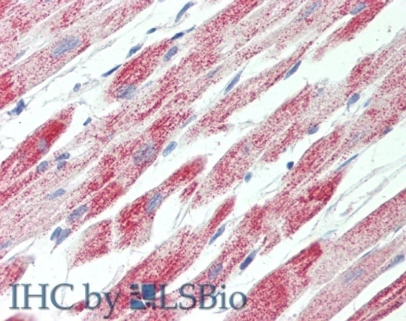 tropomyosin 4 / TPM4 Antibody