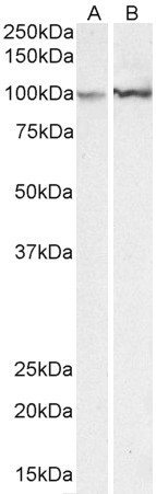 ALDOA Antibody