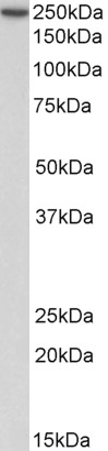 ACTN1 Antibody