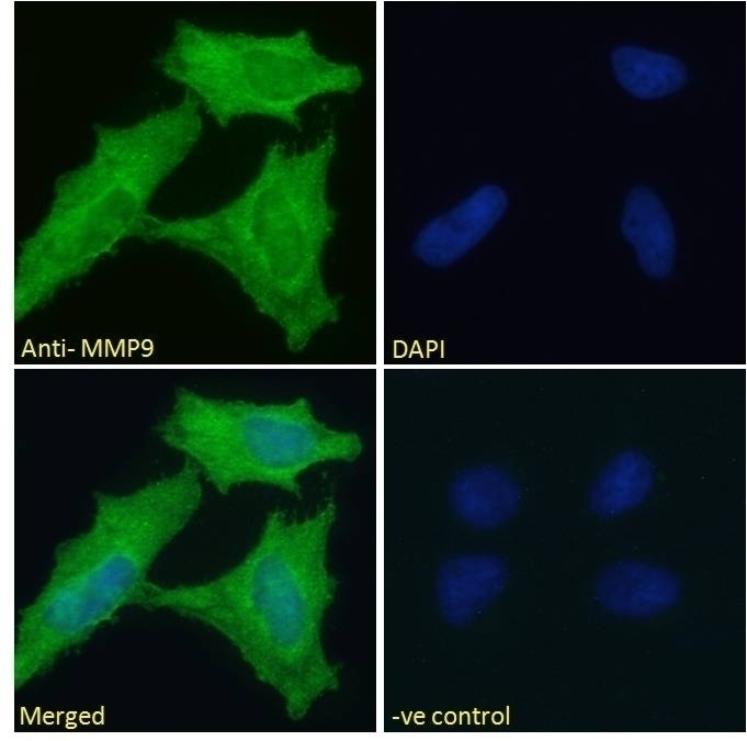 BMI1 Antibody