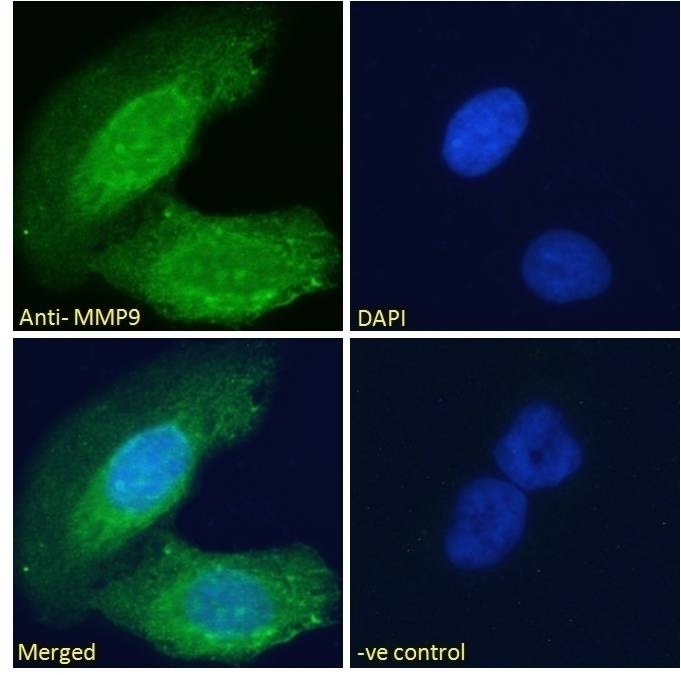 ABCG2 / BCRP Antibody