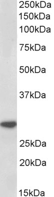 AMACR Antibody