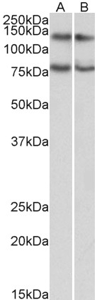 Alfy / WDFY3 Antibody