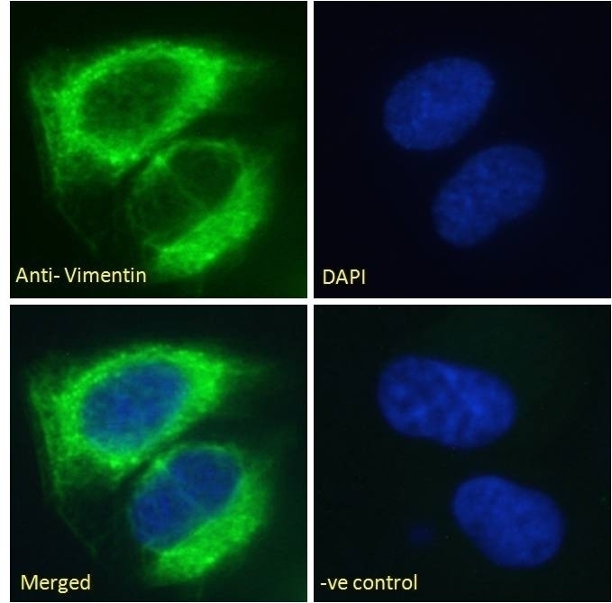 AMHR2 Antibody