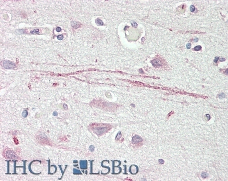 APOA1 Antibody