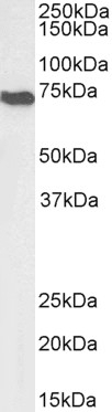 AMHR2 Antibody
