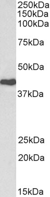 cardiac troponin T Antibody