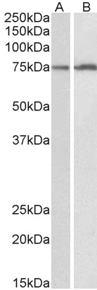 Aurora Kinase B Antibody
