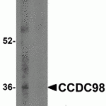 Western blot analysis of CCDC98 in human breast tissue lysate in (A) the absence and (B) presence of blocking peptide with CCDC98 antibody at 1 μg/mL.