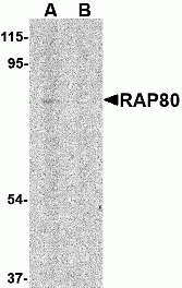RAP80 Peptide