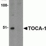 Western blot analysis of TOCA-1 in mouse brain tissue lysate with in (A) the absence and (B) the presence of blocking peptide. with TOCA-1 antibody at 1 μg/mL.