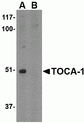 TOCA-1 Peptide