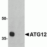 Western blot analysis of ATG12 in mouse heart tissue lysate with ATG12 antibody at 1 μg/mL in (A) the absence and (B) the presence of blocking peptide.