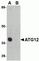 ATG12 Peptide