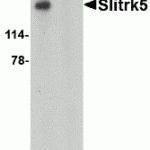 Western blot analysis of Slitrk5 in 3T3 cell lysate with Slitrk5 antibody at 1 μg/mL in the (A) absence or (B) presence of blocking peptide.