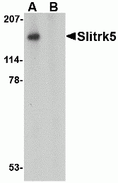 Slitrk5 Peptide