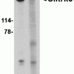 Western blot analysis of Slitrk5 in 3T3 cell lysate with Slitrk5 antibody at 1 μg/mL in the (A) absence or (B) presence of blocking peptide.